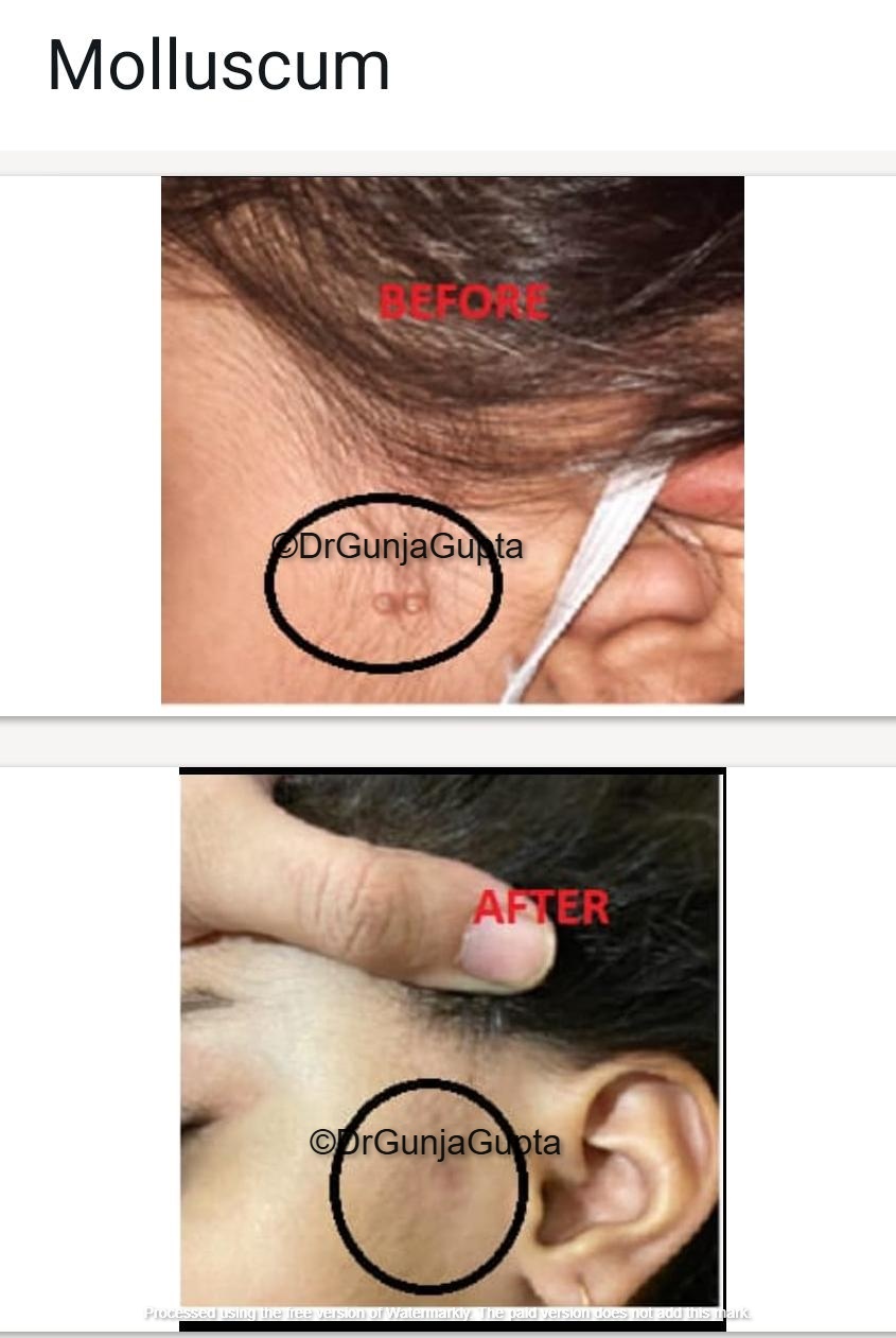 Before and After Case 1