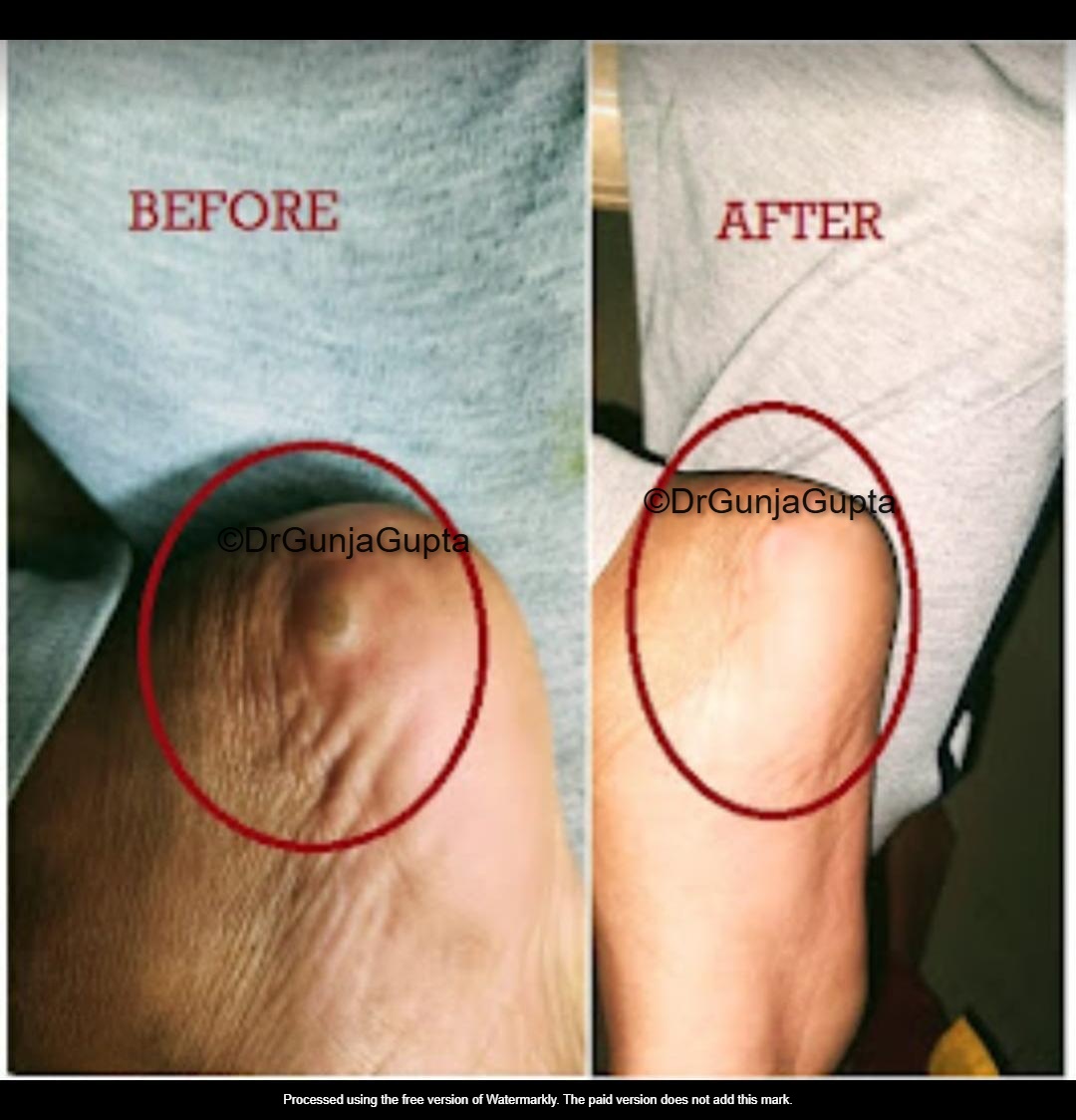 Before and After Case 4