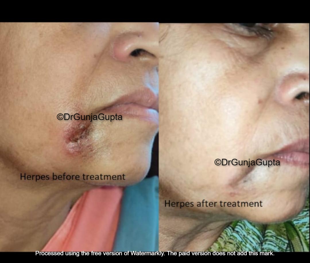 Before and After Case 5